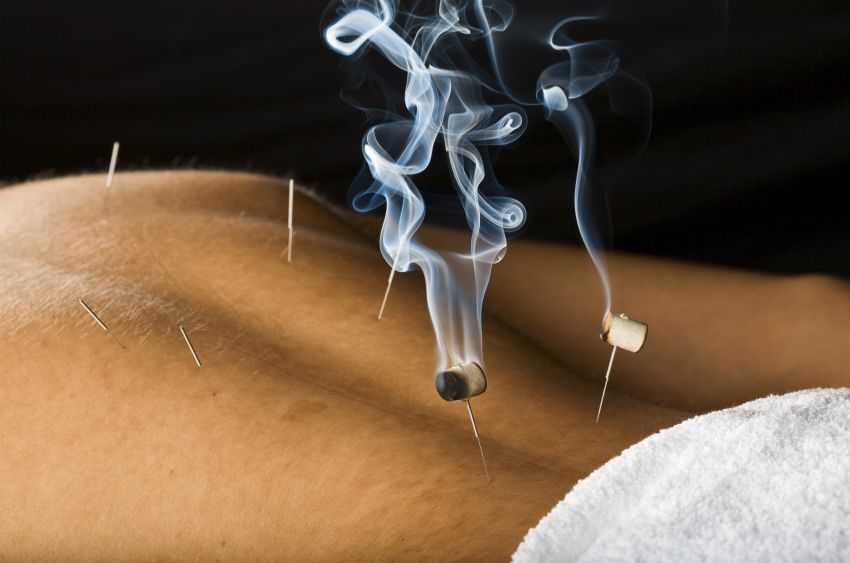 Czubek igły - leczenie akupunkturą